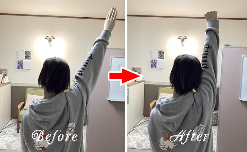 肩の痛みが改善した例 肩の痛みが改善した例