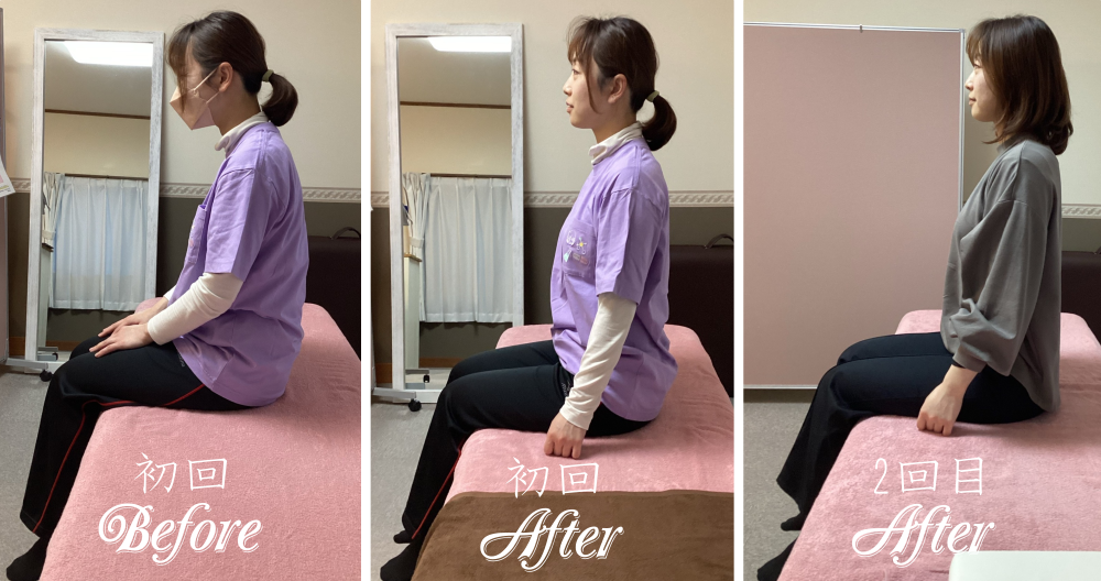 姿勢が改善した例 姿勢が改善した例