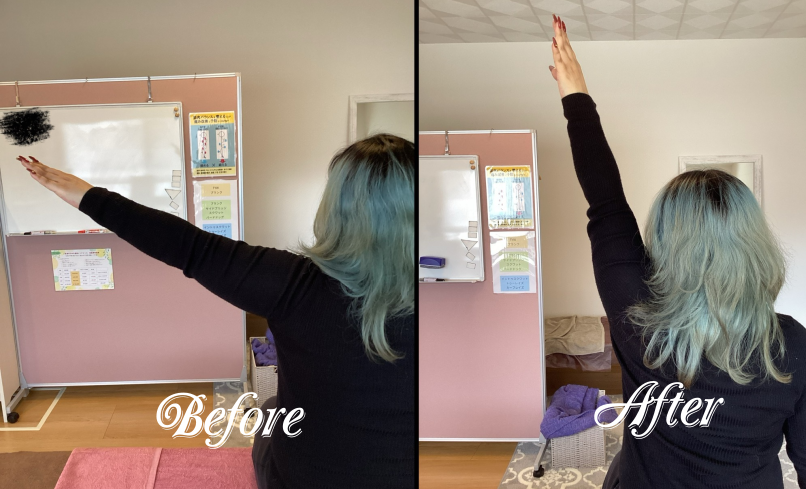 肩関節左外転可動域改善 肩関節左外転可動域改善