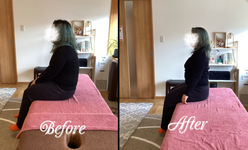 姿勢改善 姿勢改善